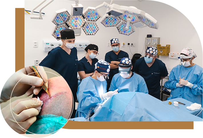 Curso Hands-on FUE Academy